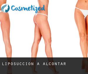 Liposuccion à Alcóntar