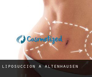 Liposuccion à Altenhausen