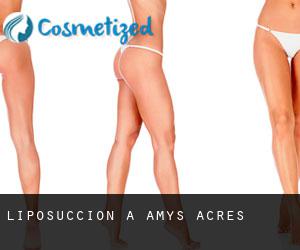 Liposuccion à Amys Acres