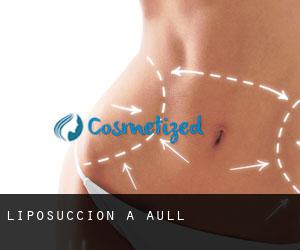 Liposuccion à Aull