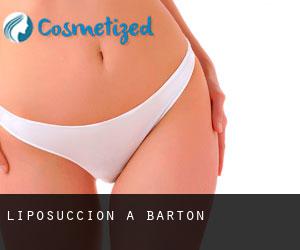 Liposuccion à Barton