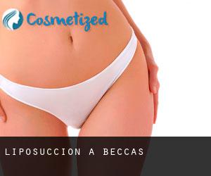 Liposuccion à Beccas