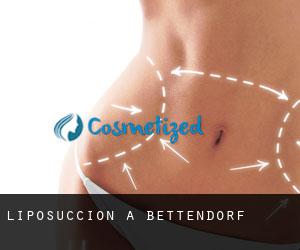 Liposuccion à Bettendorf