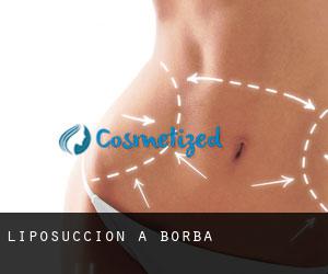 Liposuccion à Borba