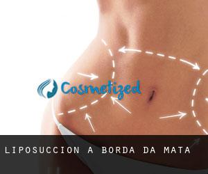 Liposuccion à Borda da Mata