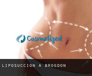 Liposuccion à Brogdon