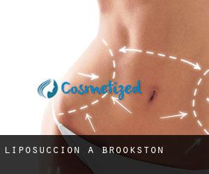 Liposuccion à Brookston