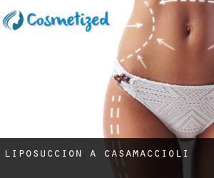 Liposuccion à Casamaccioli