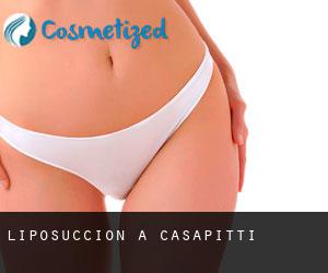 Liposuccion à Casapitti