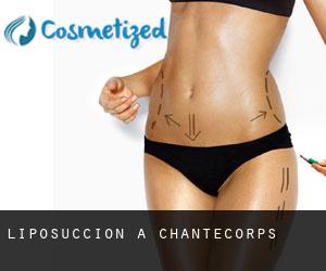 Liposuccion à Chantecorps