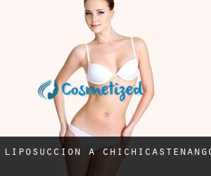 Liposuccion à Chichicastenango