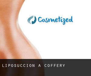 Liposuccion à Coffery