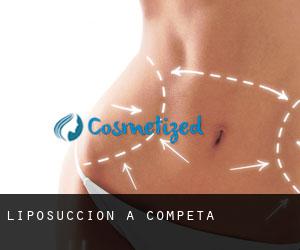 Liposuccion à Cómpeta