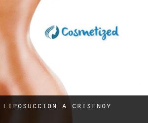 Liposuccion à Crisenoy