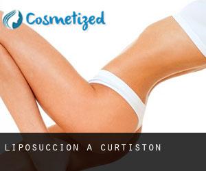 Liposuccion à Curtiston