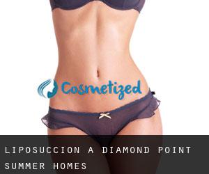 Liposuccion à Diamond Point Summer Homes