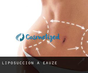 Liposuccion à Eauze