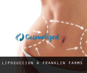 Liposuccion à Franklin Farms