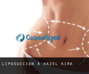 Liposuccion à Hazel Kirk