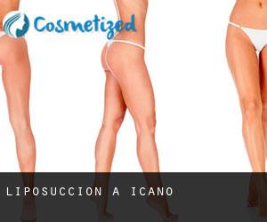 Liposuccion à Icaño