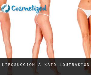 Liposuccion à Káto Loutrákion