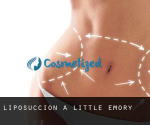 Liposuccion à Little Emory