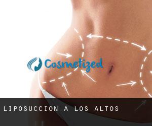 Liposuccion à Los Altos