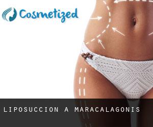 Liposuccion à Maracalagonis