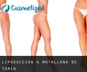 Liposuccion à Matallana de Torío