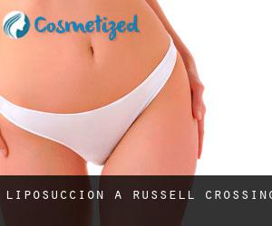 Liposuccion à Russell Crossing