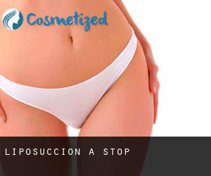 Liposuccion à Stop