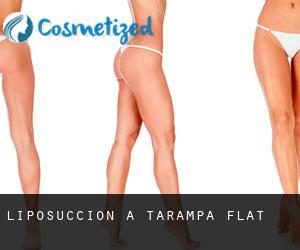 Liposuccion à Tarampa Flat