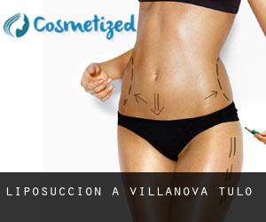 Liposuccion à Villanova Tulo