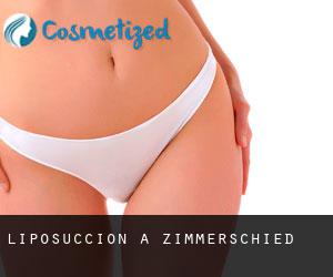 Liposuccion à Zimmerschied