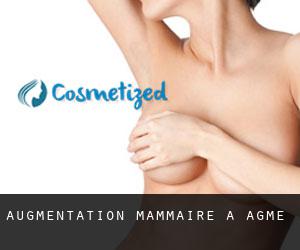 Augmentation mammaire à Agmé