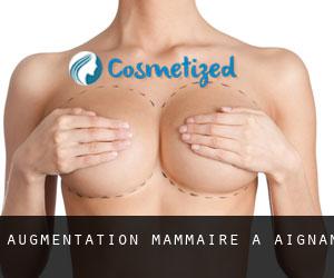 Augmentation mammaire à Aignan