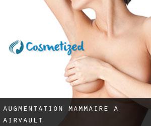 Augmentation mammaire à Airvault