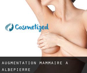 Augmentation mammaire à Albepierre