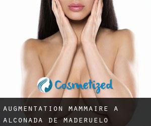 Augmentation mammaire à Alconada de Maderuelo