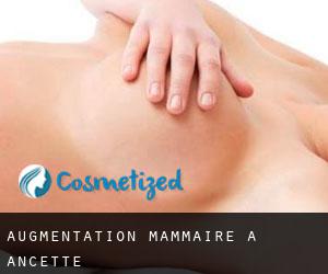Augmentation mammaire à Ancette