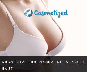 Augmentation mammaire à Angle Haut