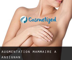 Augmentation mammaire à Ansignan