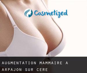 Augmentation mammaire à Arpajon-sur-Cère