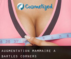 Augmentation mammaire à Bartles Corners
