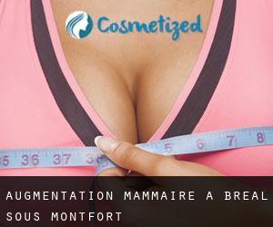 Augmentation mammaire à Bréal-sous-Montfort