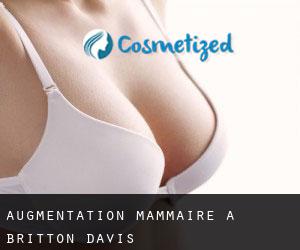 Augmentation mammaire à Britton Davis