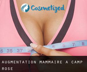 Augmentation mammaire à Camp Rose