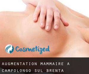 Augmentation mammaire à Campolongo sul Brenta