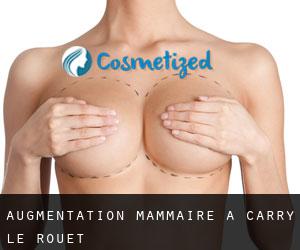 Augmentation mammaire à Carry-le-Rouet
