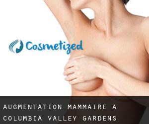 Augmentation mammaire à Columbia Valley Gardens